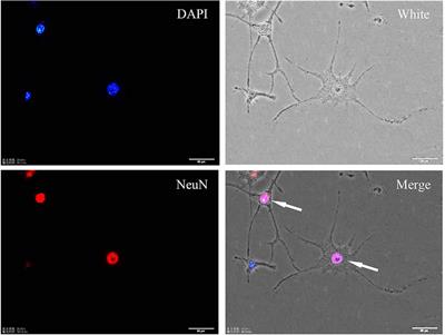 Class I HDAC Inhibitor Improves Synaptic Proteins and Repairs Cytoskeleton Through Regulating Synapse-Related Genes In vitro and In vivo